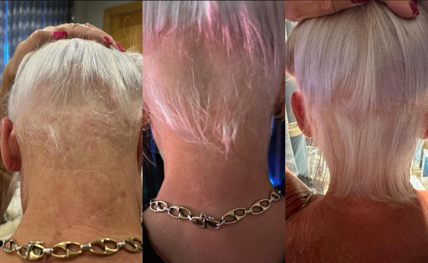 Online Hair Loss analysis with tailored product & treatment advice
